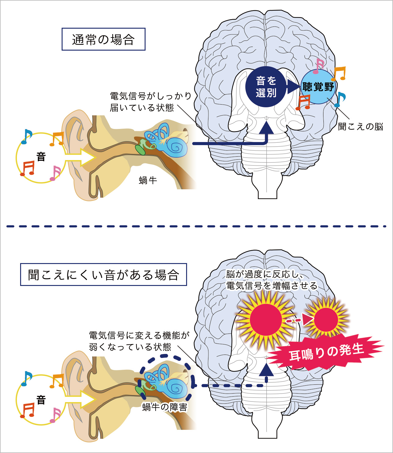脳が音を認識する仕組み