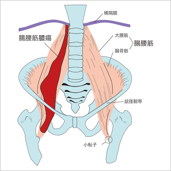 腸腰筋の位置とその周囲の名称