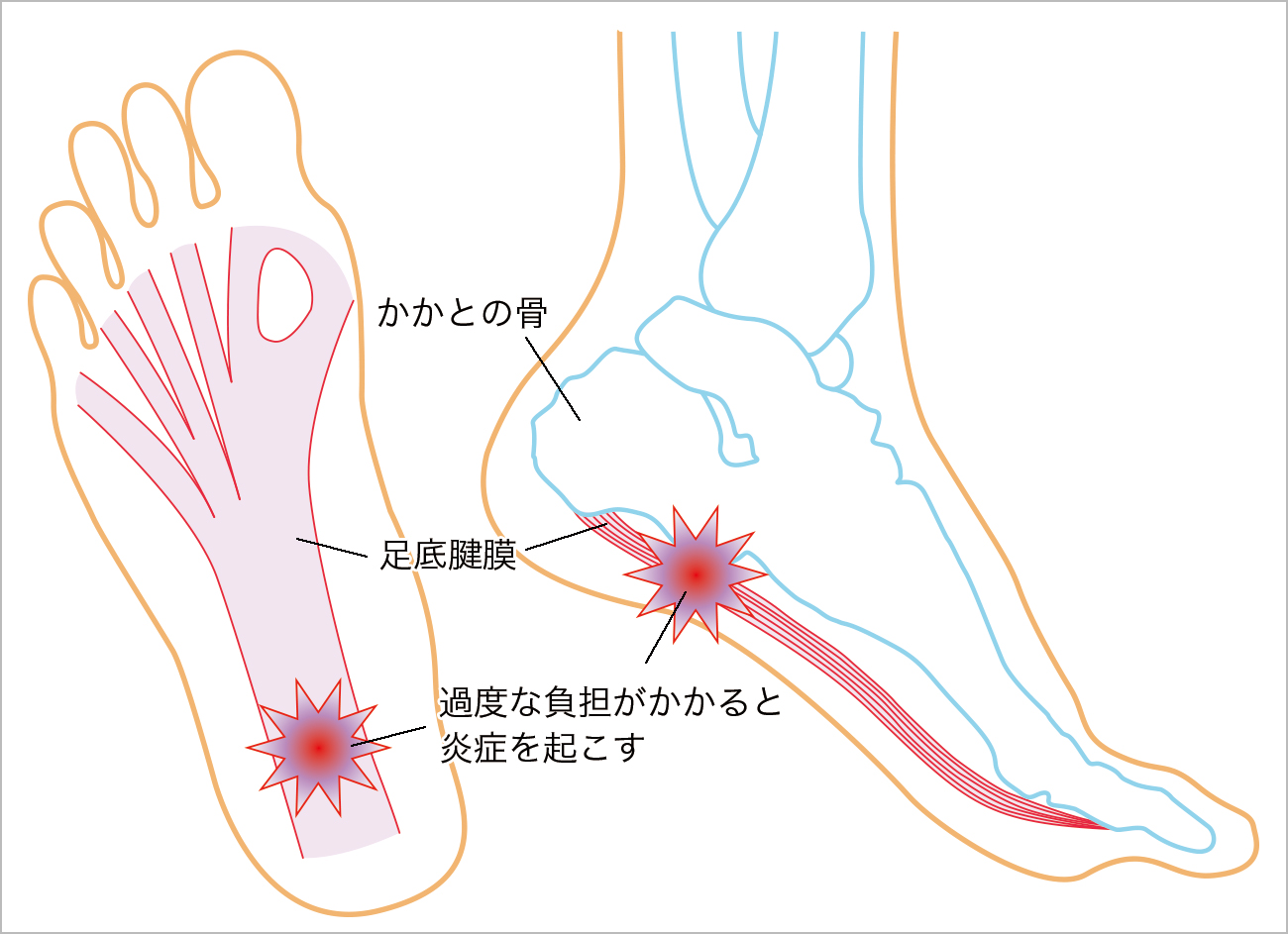 足底腱膜解剖