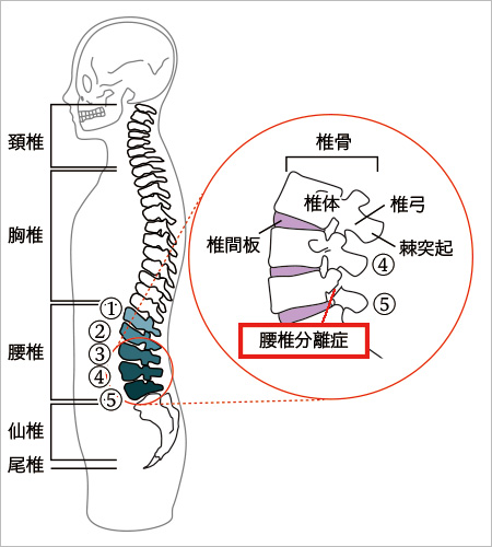 腰椎の構造と腰椎分離症