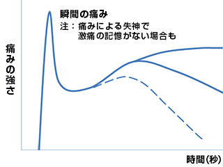 Aタイプ［突発完成I型］