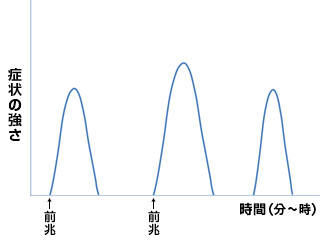 Dタイプ［反復II型］