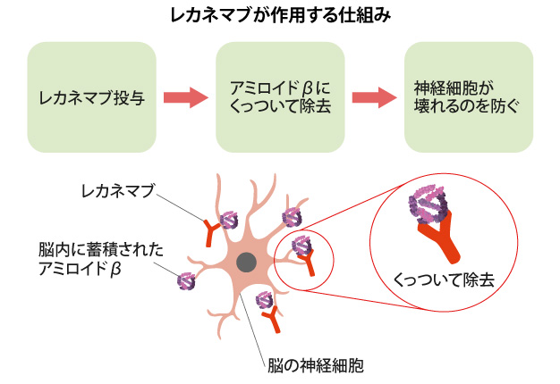 レカネマブが作用する仕組みの図解