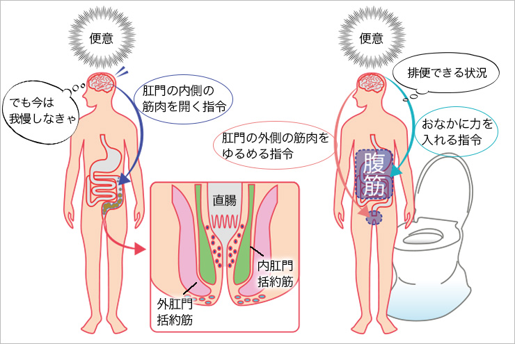 夏の脱水が原因に 子供の便秘にご用心！