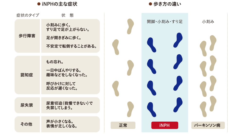 iNPHの主な症状