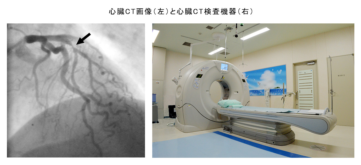 心臓CT画像（左）と心臓CT検査機器（右）