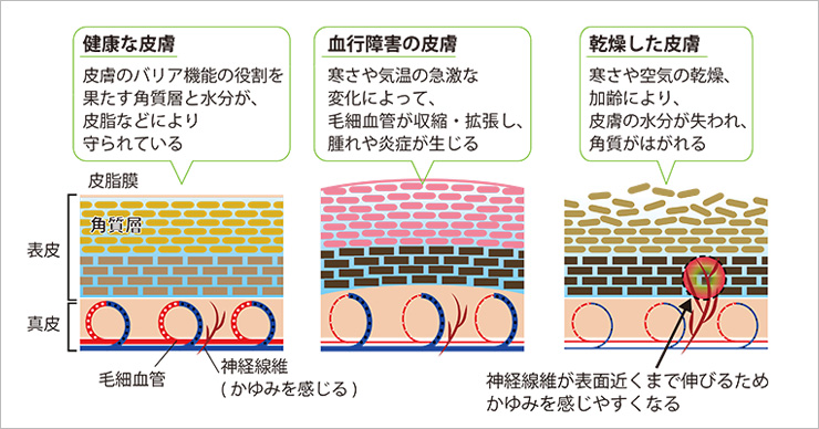 皮膚トラブル