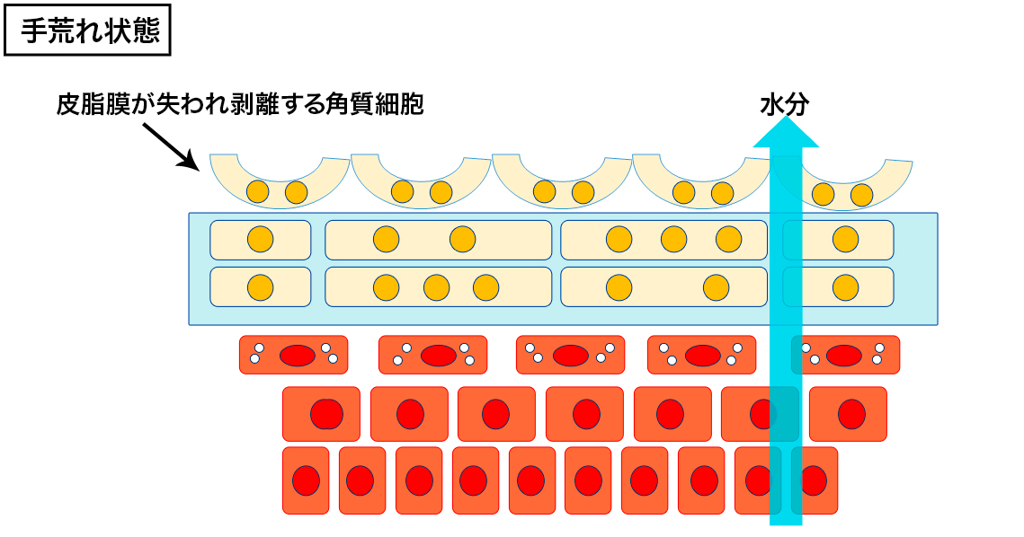 皮膚の表層断面(手荒れ)