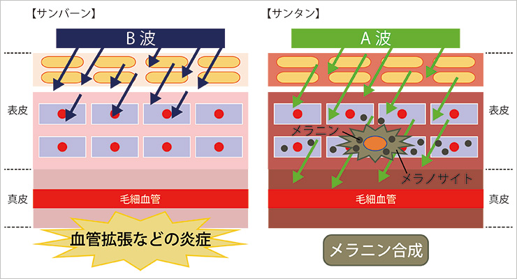 日焼けのメカニズム