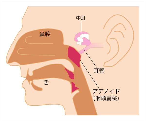 「アデノイド」の画像検索結果