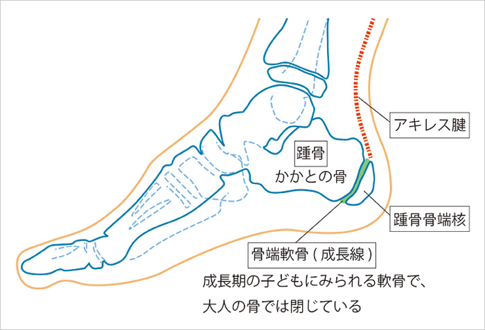 踵骨骨端症 セーバー病 シーバー病 しょうこつこったんしょう 済生会