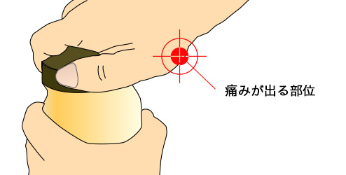 早期発見のポイント