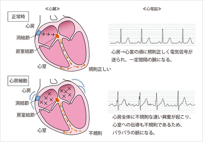 心臓と心電図