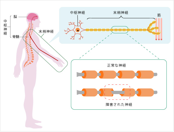 中枢神経と末梢神経の障害