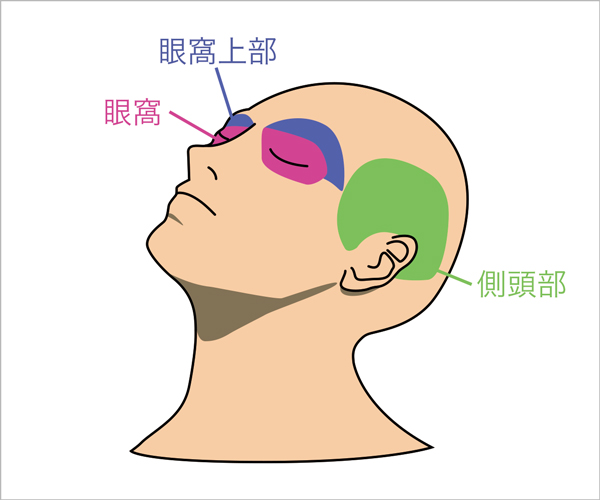 詰まり 頭痛 鼻