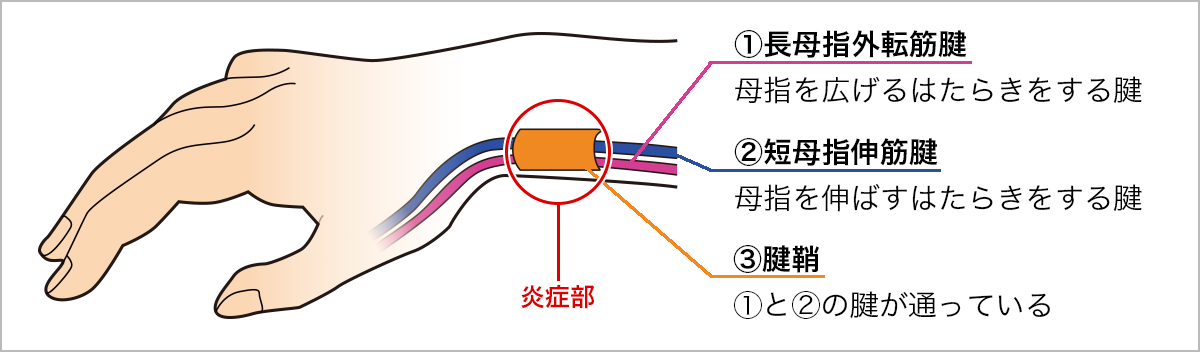 ããã±ã«ãã³çãã®ç»åæ¤ç´¢çµæ