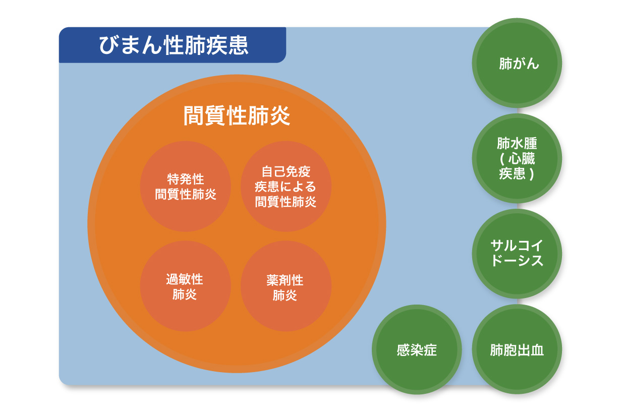 びまん性肺疾患