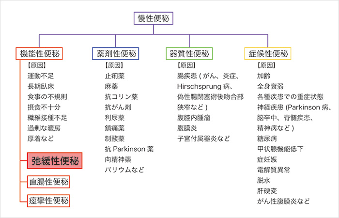 慢性便秘の種類