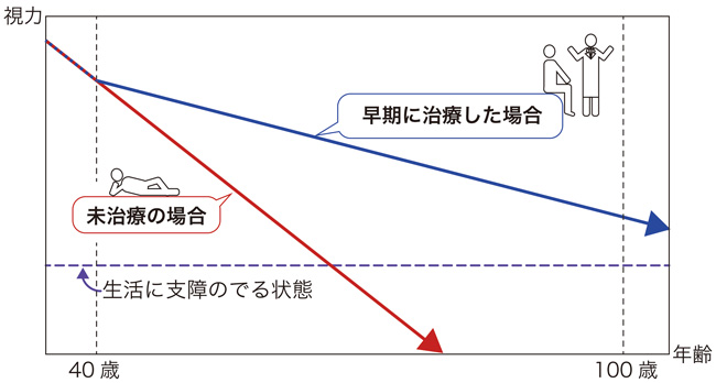 緑内障の治療と視力