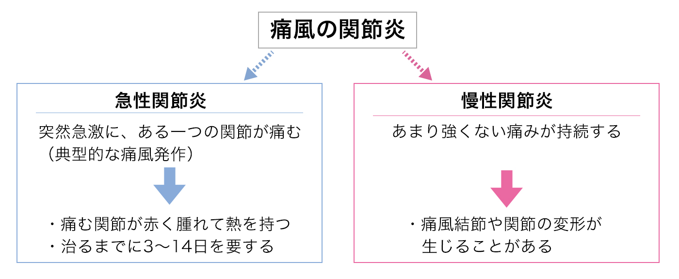 発作 長引く 痛風