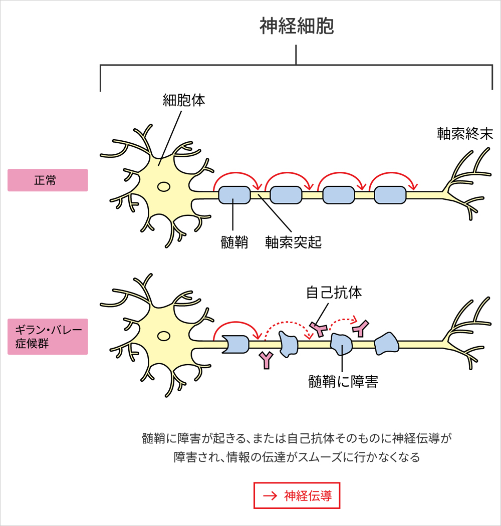 図: 神経細胞の仕組み