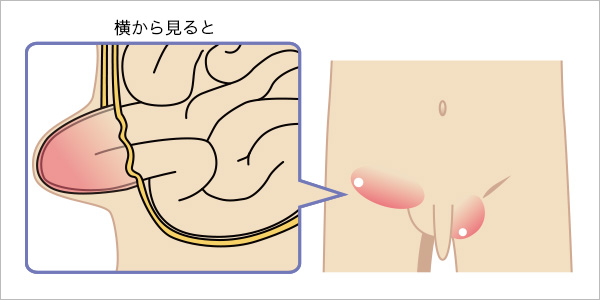 痛み 鼠径 部