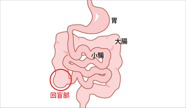 発症しやすい部位