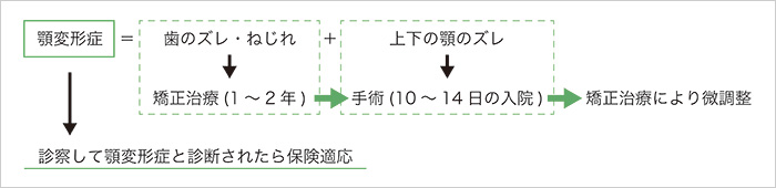 顎変形症と治療法