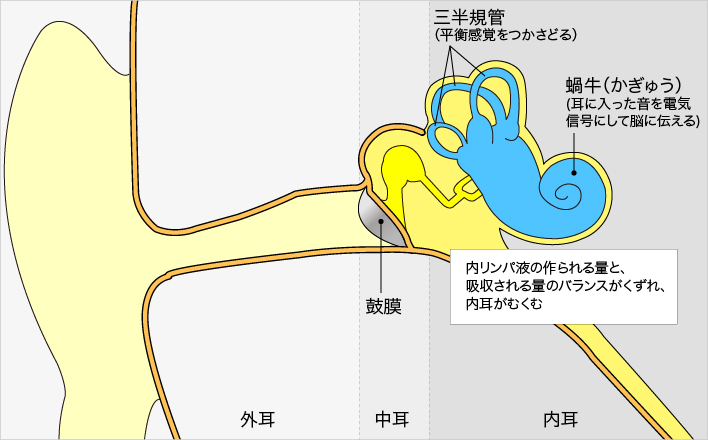 メニエール病 めにえーるびょう 済生会