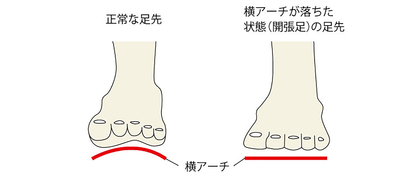 開張足 かいちょうそく 済生会