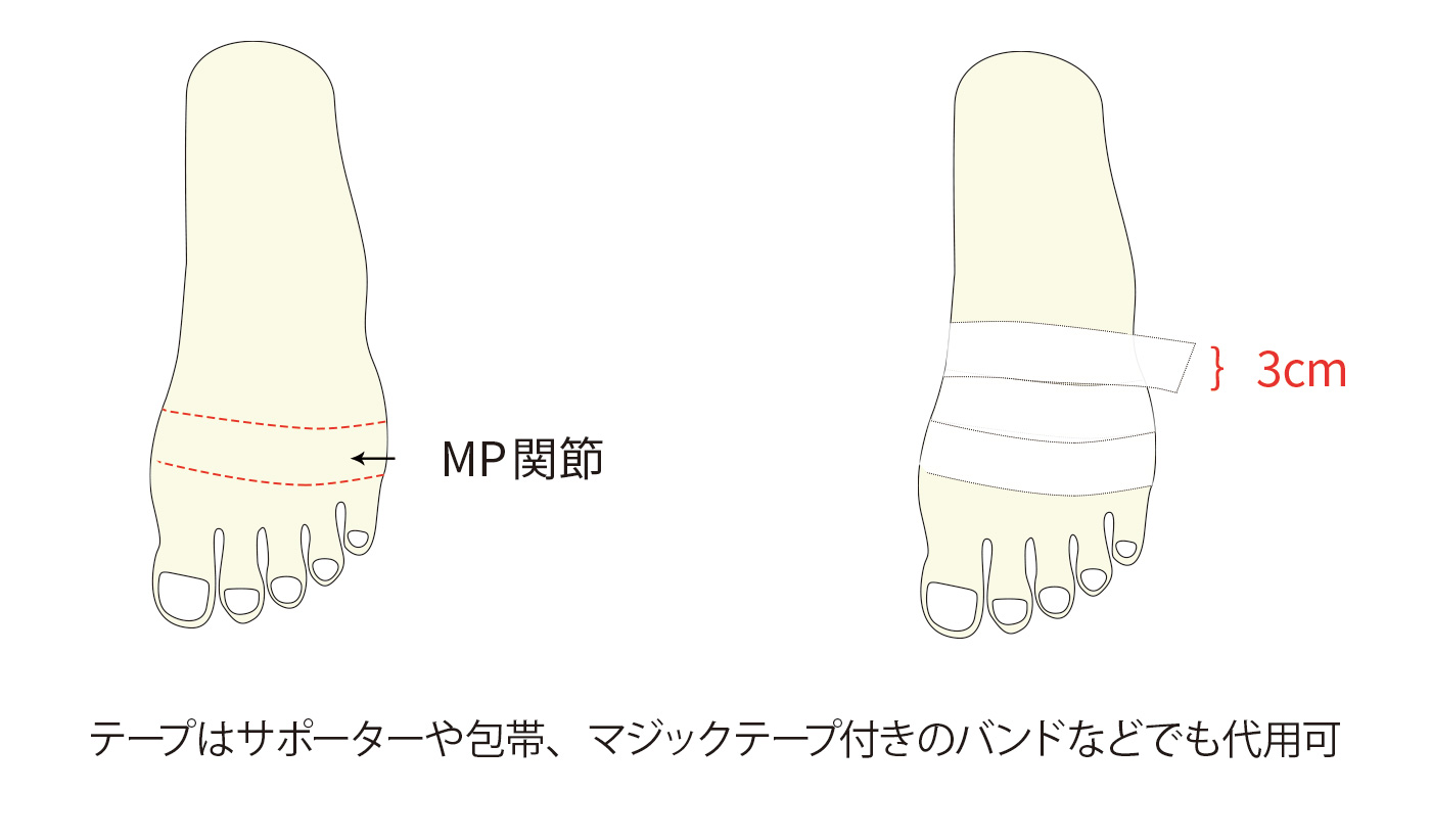 開張足 かいちょうそく 済生会