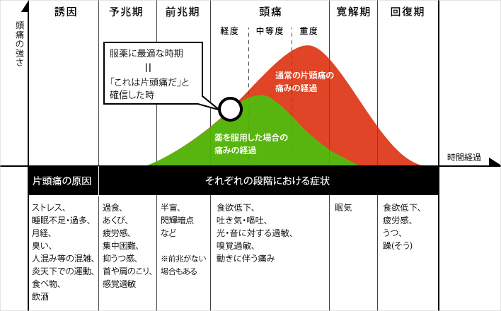 片頭痛 へんずつう 済生会