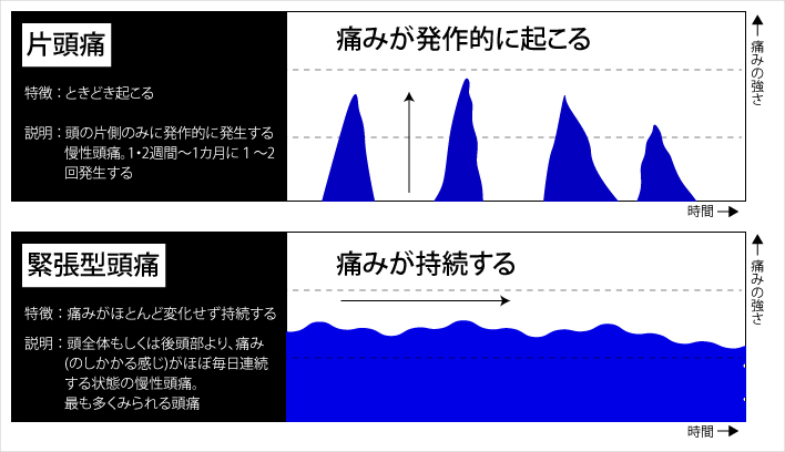 片頭痛