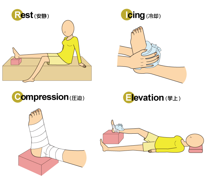 RICE処置とは