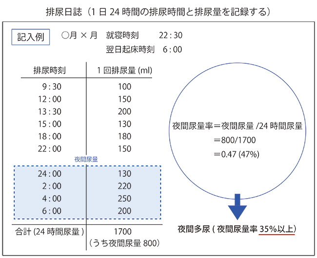 排尿日誌