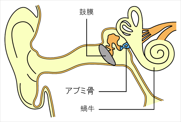 耳硬化症