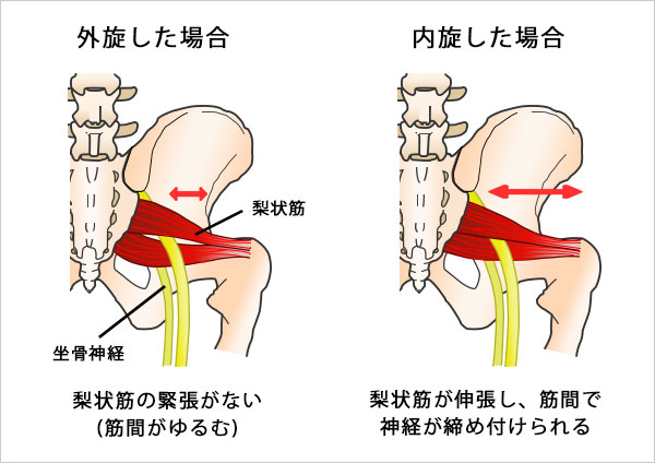 梨 状 筋 作用