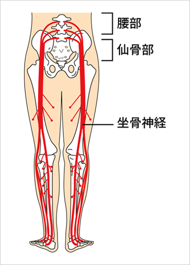 神経痛 の 症状 座骨