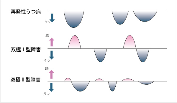 情緒 不 安定 病気