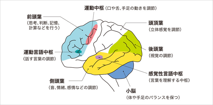 脳卒中から起こる失語症