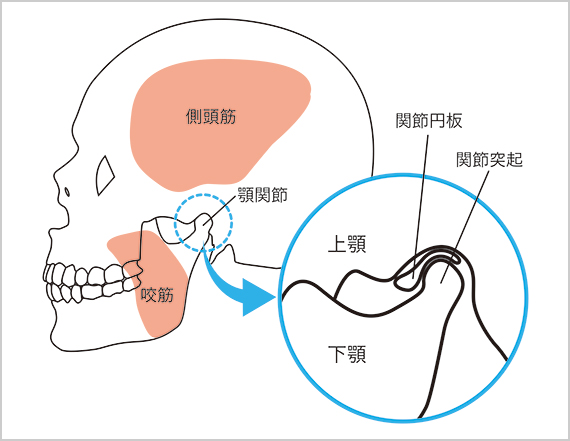 治療 法 関節 額 痛 症