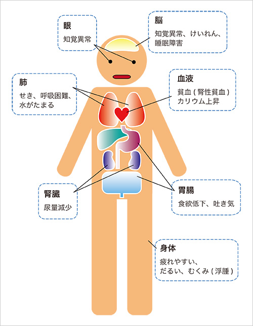 尿毒症症状例