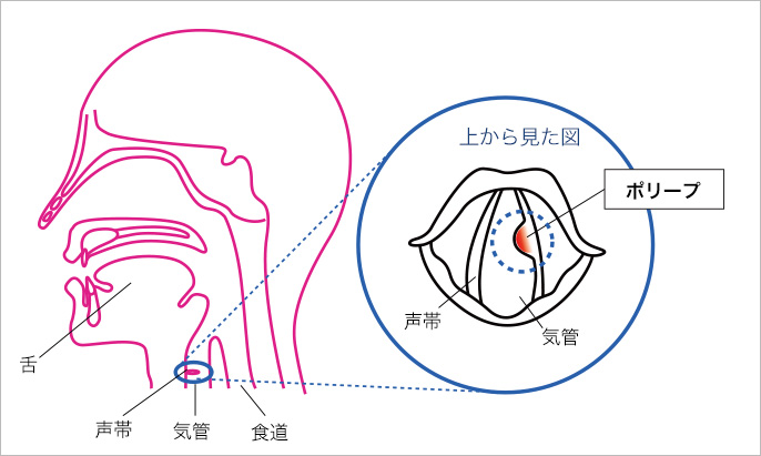 声帯の位置