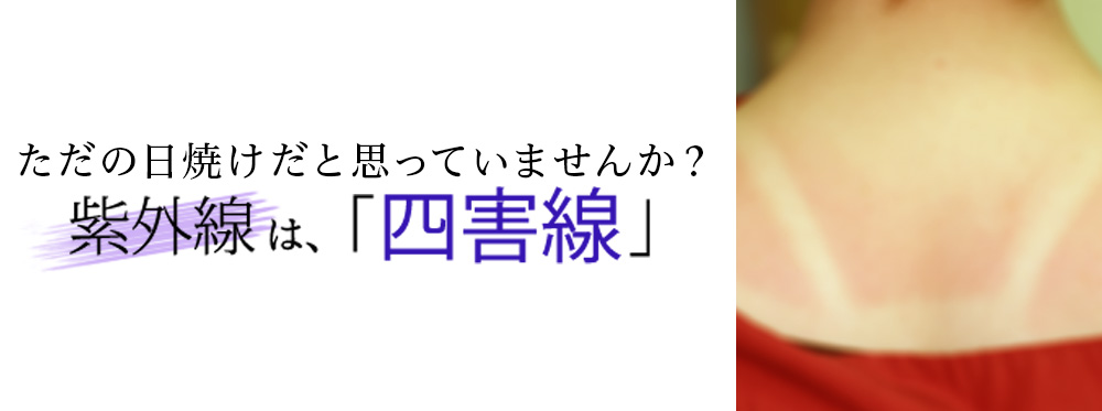 ただの日焼けだと思っていませんか？　紫外線は「四害線」