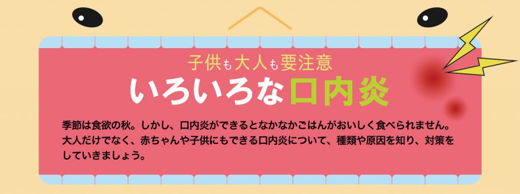 子供も大人も要注意 いろいろな口内炎