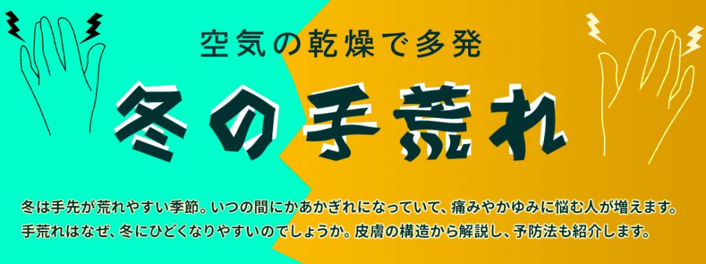 空気の乾燥で多発 冬の手荒れ