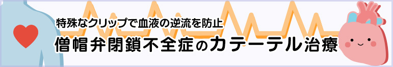 特殊なクリップで血液の逆流を防止　僧帽弁閉鎖不全症のカテーテル治療