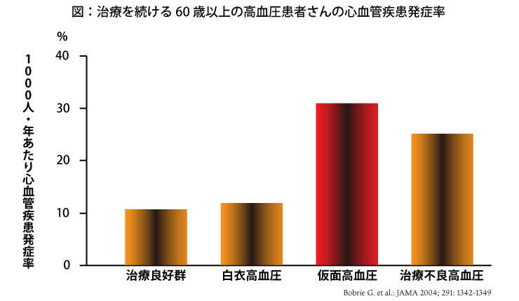 仮面高血圧の患者さんの30%以上が治療中にもかかわらず心血管疾患を発症する