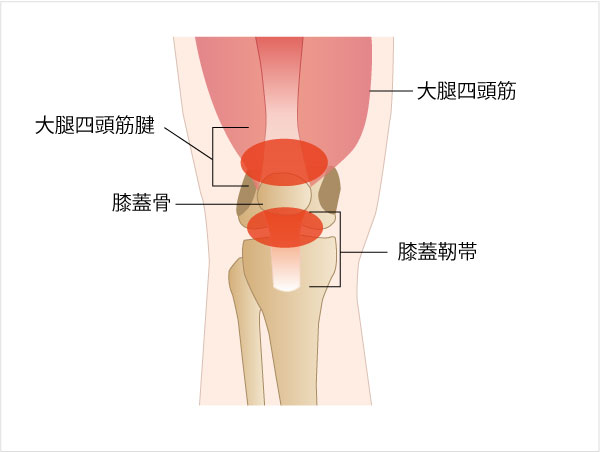 図：ジャンパー膝が起こりやすい場所