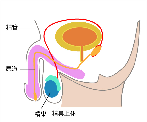 大精嚢 